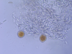 Sphaerellopsis filum