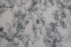 Streptomyces