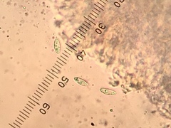 Biatora longispora