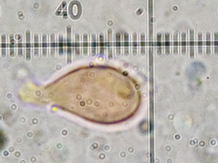 Crustomyces subabruptus