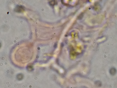 Crustomyces subabruptus