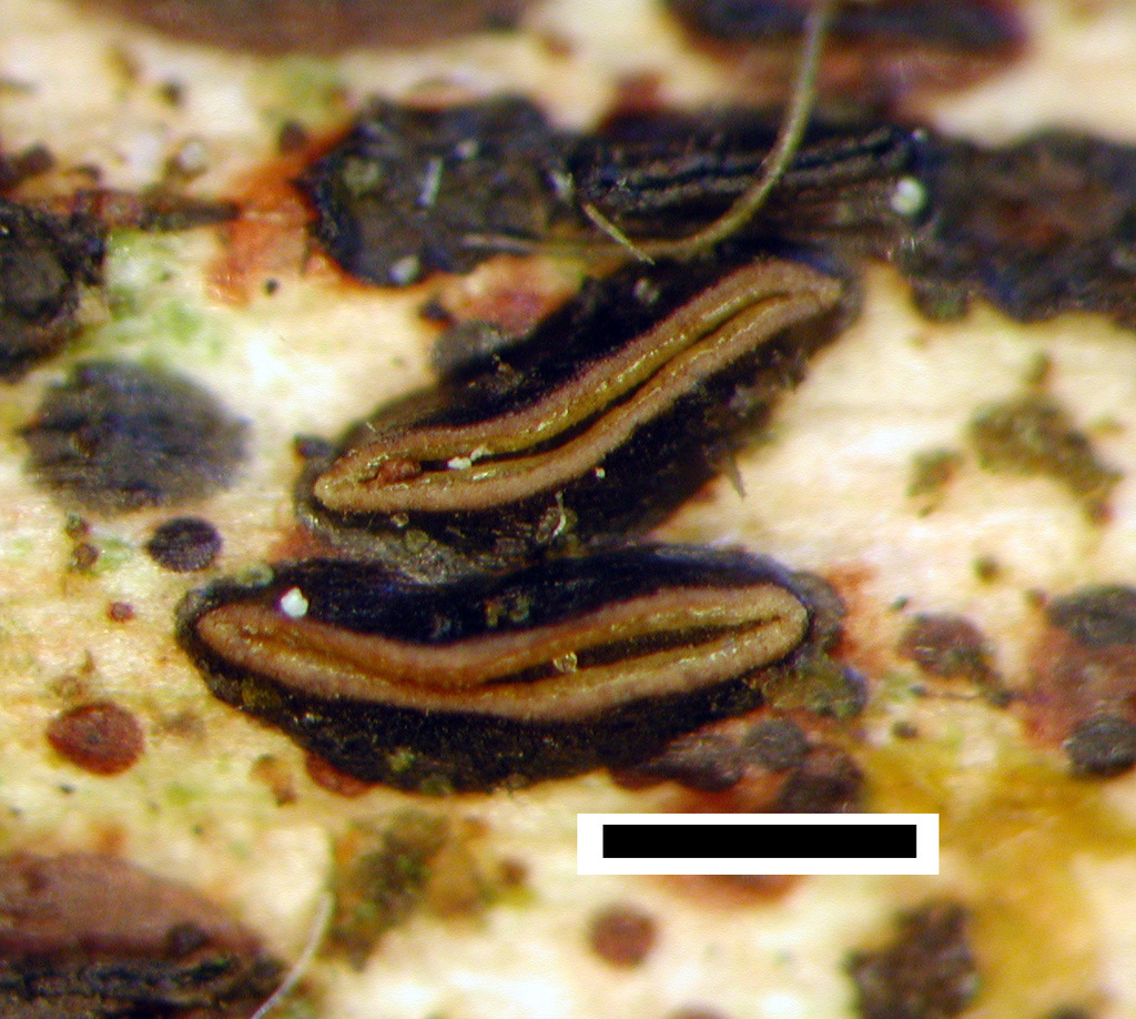 Hypoderma