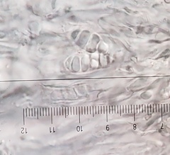 Scytinium dactylinum
