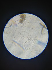 Tubeufiales