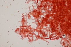 Botryobasidium vagum