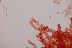 Botryobasidium vagum