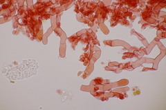 Botryobasidium vagum