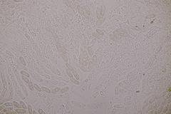 Thyronectria