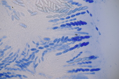 Thyronectria