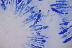 Thyronectria