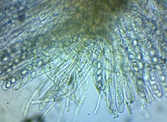 Chaetothiersia