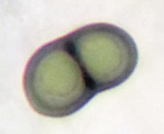 Rinodina pachysperma