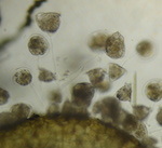 Vorticella campanula