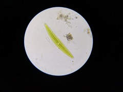 Closterium acerosum lanceolatum