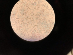 Bacillus subtilis