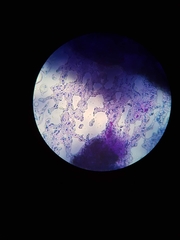 Bacillus subtilis