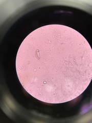 Spirometra mansonoides