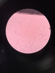 Spirometra mansonoides