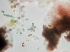 Calicium montanum
