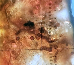 Bagliettoa calciseda