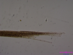 Aphanizomenon flosaquae