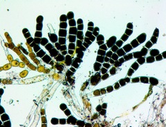 Asterosiphon dichotomus