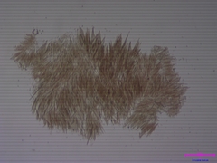 Aphanizomenon flosaquae