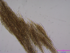 Aphanizomenon flosaquae