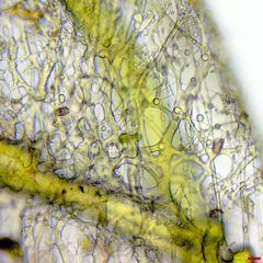 Phalacrotophora epeirae