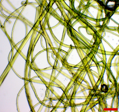 Phalacrotophora epeirae