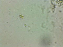 Desmodesmus abundans