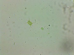 Desmodesmus abundans