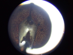 Toxomerus verticalis