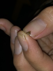 Ixodes holocyclus