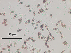 Chaenothecopsis sitchensis
