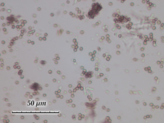 Chaenotheca trichialis