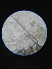 Colletotrichum trichellum