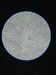 Colletotrichum trichellum