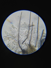 Colletotrichum trichellum