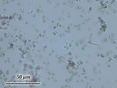 Chaenotheca gracilenta