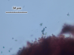 Chaenothecopsis consociata