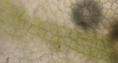 Metzgeria leptoneura
