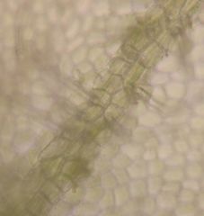 Metzgeria leptoneura