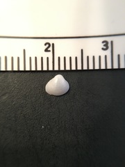 Varicorbula limatula