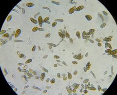 Alternaria