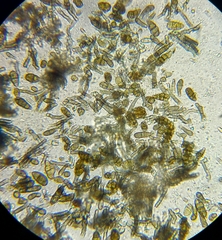 Alternaria