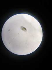Ostracoda