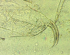 Daphnia ambigua
