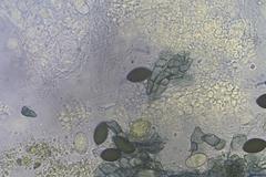 Podospora tetraspora