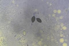 Podospora tetraspora